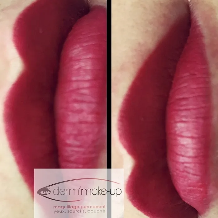 Voilage complet de bouche